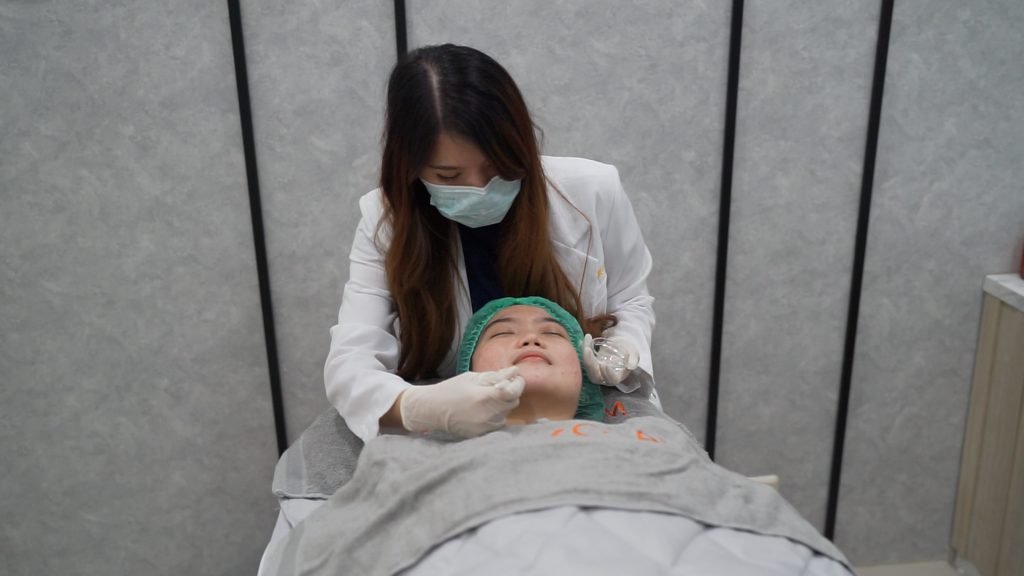 Treatment Chemical peeling
