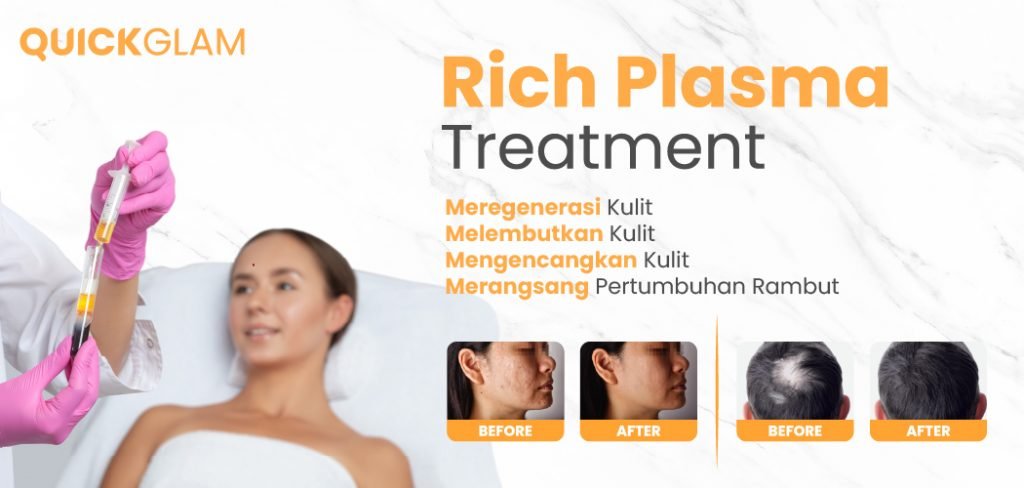 Ingin coba PRP Treatment? Simak dulu Penjelasannya berikut ini