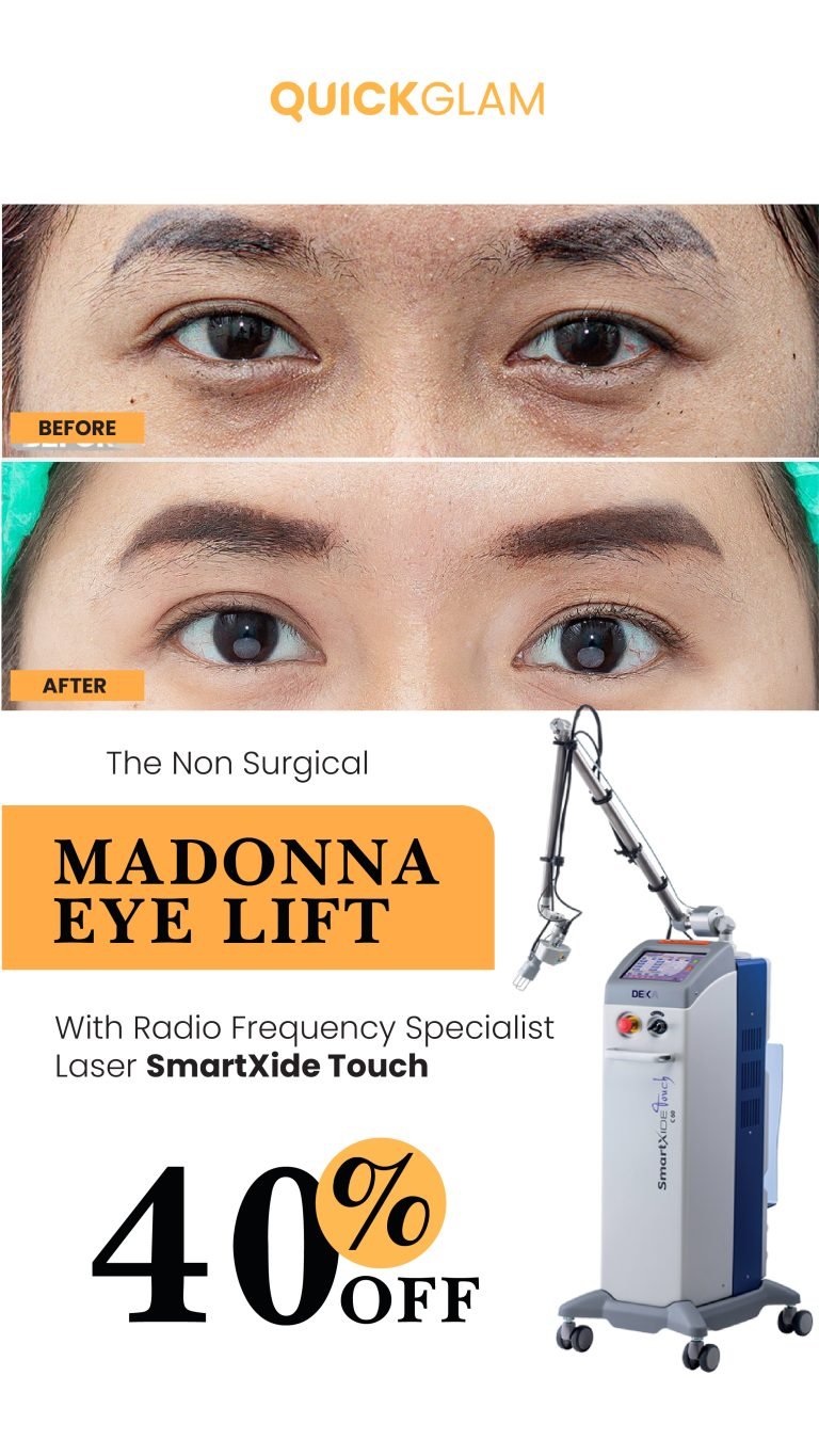 madonna-eye-lift-page-quickglam-clinic