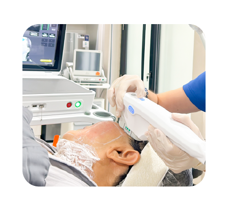 Ulthera Prime Website juni 20245-20