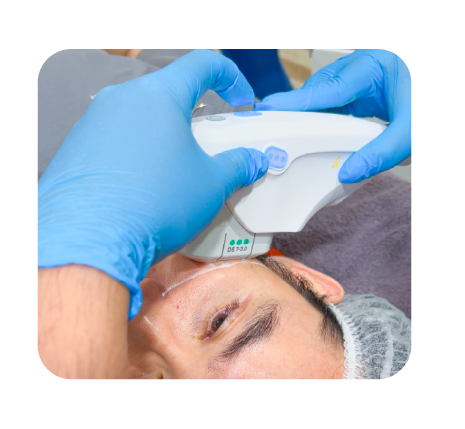 Ulthera Prime Website juni 20245-21 (1)