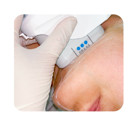 Ulthera Prime Website juni 20245-22