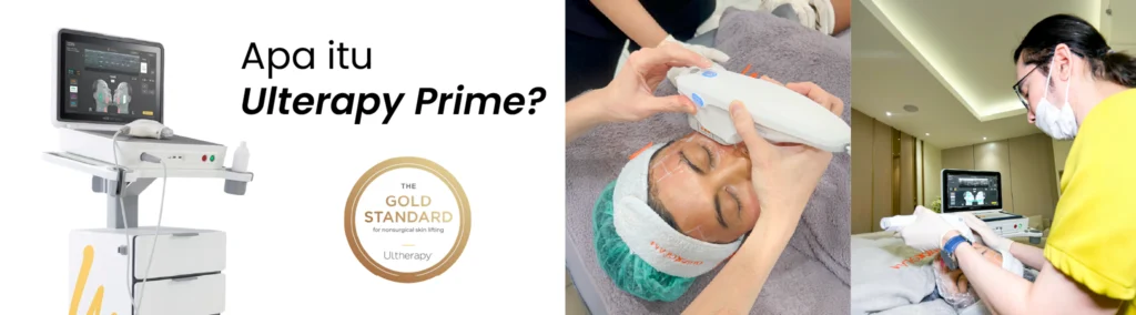 Apa Itu Ultherapy Prime