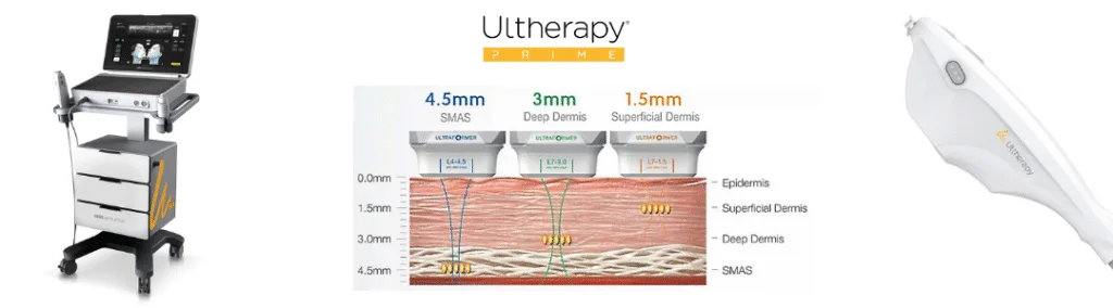 Alat treatment Ultherapy Prime