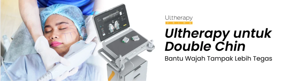7 - Ultherapy untuk Double Chin